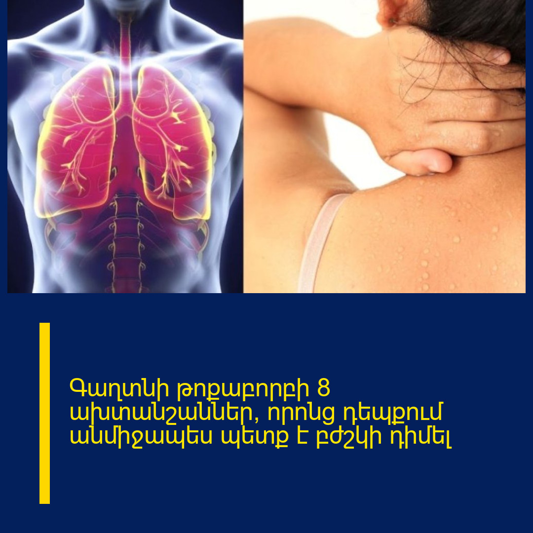 Գաղտնի թոքաբորբի 8 ախտանշաններ, որոնց դեպքում անմիջապես պետք է բժշկի դիմել