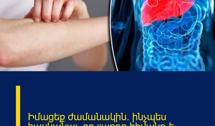 Իմացեք ժամանակին. ինչպես հասկանալ, որ լյարդը հիվանդ է