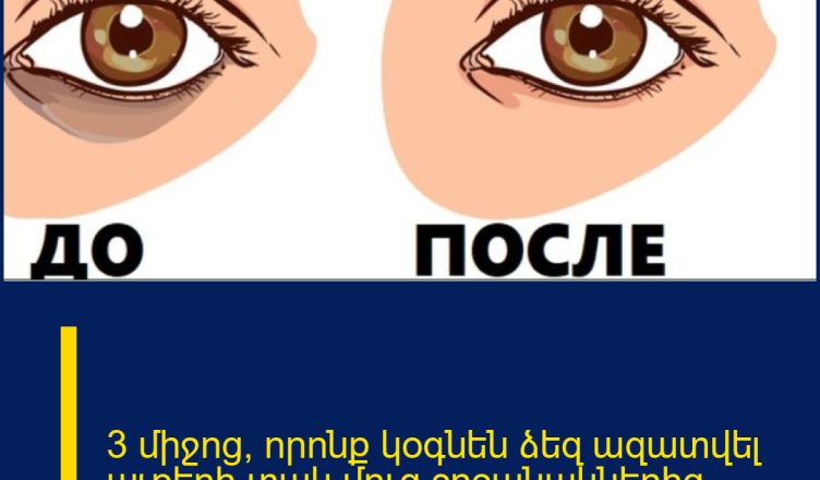 3 միջոց, որոնք կօգնեն ձեզ ազատվել աչքերի տակ մուգ շրջանակներից։