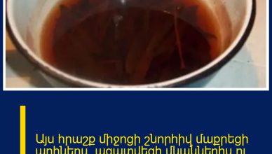 Այս հրաշք միջոցի շնորհիվ մաքրեցի աղիներս, ազատվեցի մկաններիս ու ծնկներիս ցավից