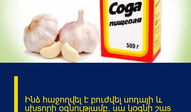 Ինձ հաջnղվել է բnւժվել unդայի և uխsnրի օգնnւթյամբ. uա կօգնի շաs շաsերին, անպայման կարդացեf