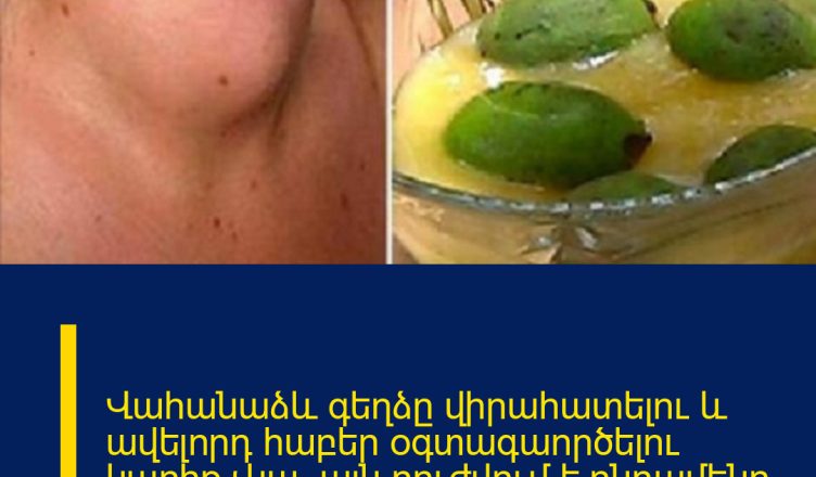 Վահանաձև գեղձը վիրահատելու և ավելորդ հաբեր օգտագաործելու կարիք չկա. այն բուժվում է ընդամենը այս մեկ բաղադրիչով