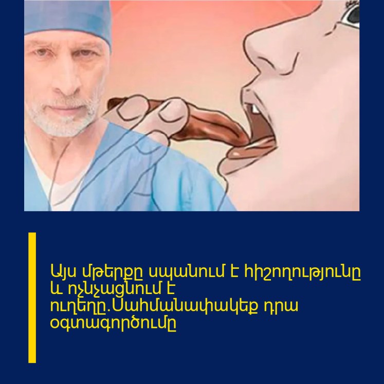 Այս մթերքը սպանում է հիշողությունը և ոչնչացնում է ուղեղը.Սահմանափակեք դրա օգտագործումը