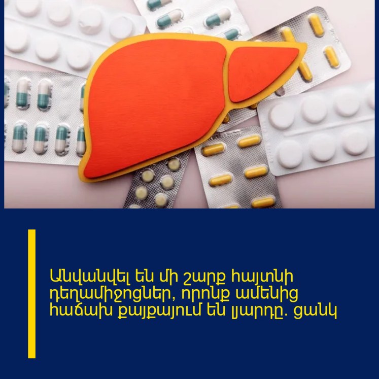 Անվանվել են մի շարք հայտնի դեղամիջոցներ, որոնք ամենից հաճախ քայքայում են լյարդը․ ցանկ