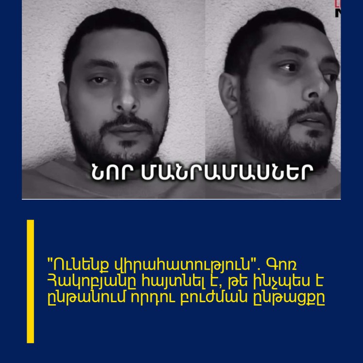 «Ունենք վիրահատություն». Գոռ Հակոբյանը հայտնել է, թե ինչպես է ընթանում որդու բուժման ընթացքը «Ունենք վիրահատություն». Գոռ Հակոբյանը հայտնել է, թե ինչպես է ընթանում որդու բուժման ընթացքը