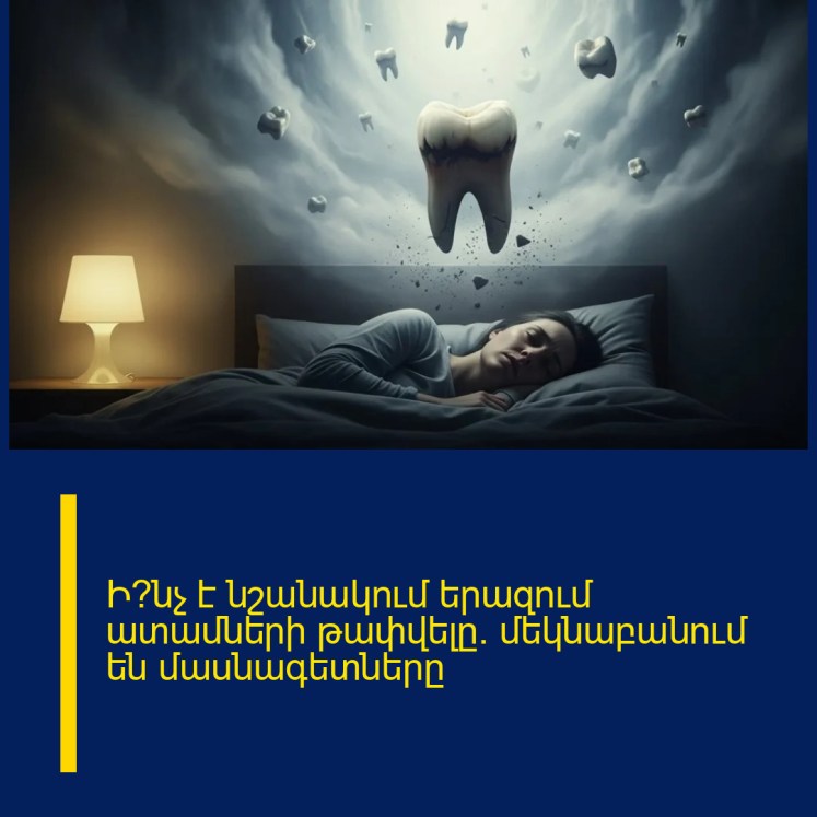 Ի՞նչ է նշանակում երազում ատամների թափվելը․ մեկնաբանում են մասնագետները Ի՞նչ է նշանակում երազում ատամների թափվելը․ մեկնաբանում են մասնագետները