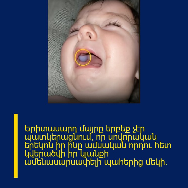 Երիտասարդ մայրը երբեք չէր պատկերացնում, որ սովորական երեկոն իր ինը ամսական որդու հետ կվերածվի իր կյանքի ամենասարսափելի պահերից մեկի։