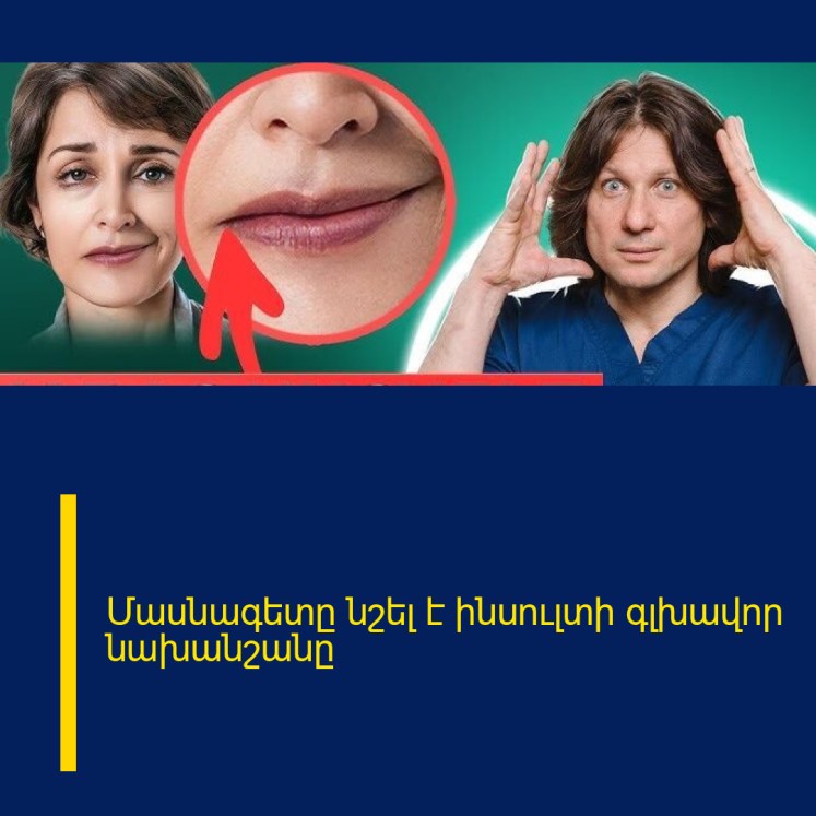 Մասնագետը նշել է ինսուլտի գլխավոր նախանշանը Մասնագետը նշել է ինսուլտի գլխավոր նախանշանը